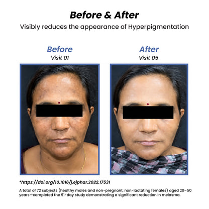 Seekcaus Lumiveil Hyperpigmentation Sunscreen SPF 50 PA++++ | Prevents Hyperpigmentation Recurrence | Blue Light Protection | Alpha Arbutin | Lightweight Fluid Sunscreen | Broad Spectrum UVA UVB Protection | 50ml